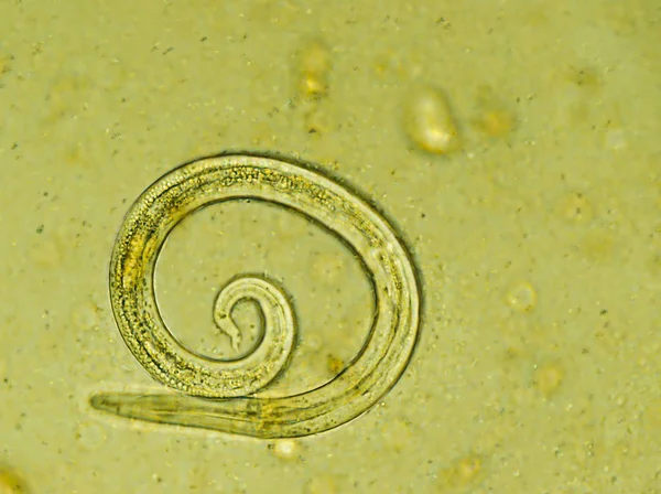 Aelurostrongylus abstrusus larva izolovaný pod mikroskopem — Stock fotografie