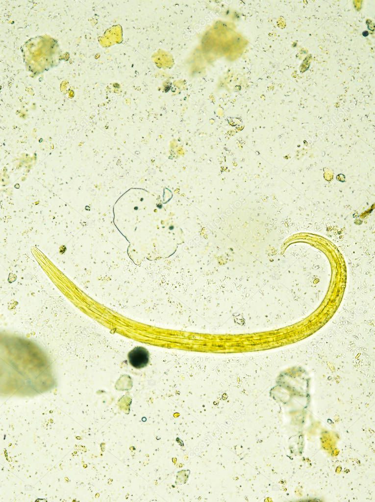 Aelurostrongylus abstrusus larva isolated, under the microscope