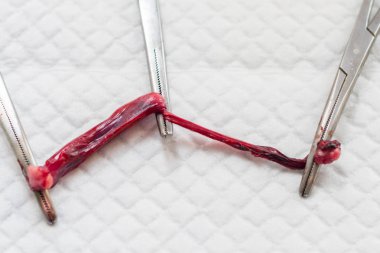 bir kedinin anormal rahim boynuzları