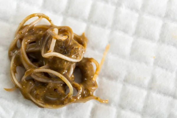 bir sokak kedisi Toxocara cati ile dışkı