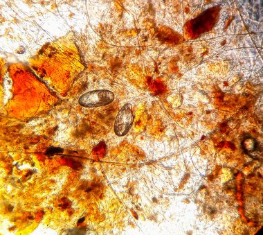 Mikroskop altında bir kedinin kulaklığı.