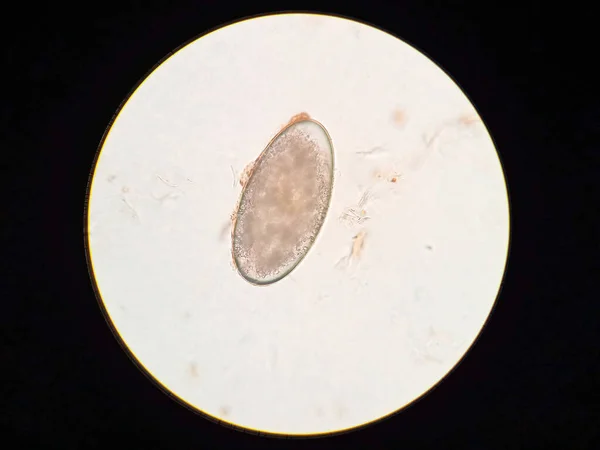 Ear Mite Egg Cat Microscope — Stock Photo, Image