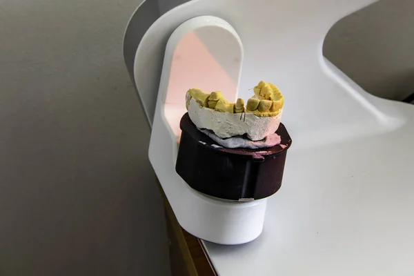 protez üretimi için 3d tarayıcıda döküm taraması