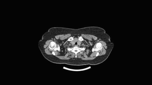 MRI-Scan der Lungen und Bronchien, Diagnose von Atemwegserkrankungen — Stockvideo