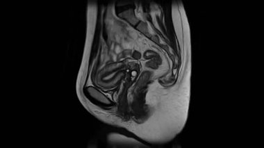 Abdominal kavite ve retroperitoneal alan kontrast Mrg taraması, patolojilerin saptanması