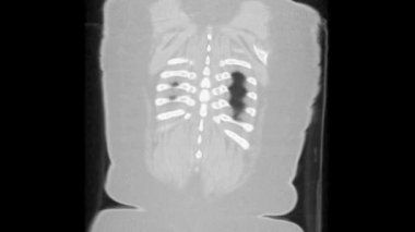 Akciğer ve bronşların MRtaraması, solunum yolu hastalıklarının tanısı