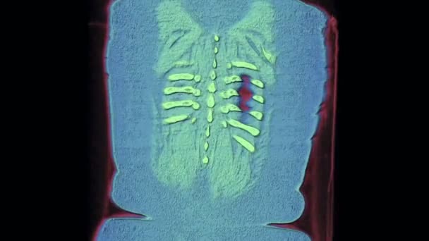 3D-kleur MRI-scan van de longen en bronchiën, diagnose van ademhalingsziekten — Stockvideo
