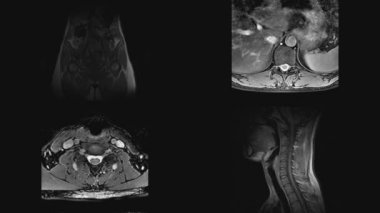 İnsan vücudunun Mri taramalarının farklı bölümlerini dilimliyor. Manyetik rezonans görüntüleme ile sağlık sorunlarının incelenmesi ve tanımlanması