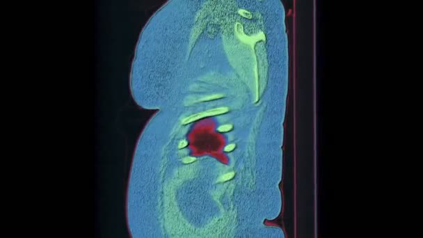 Resonancia magnética en color de los pulmones y bronquios, diagnóstico de enfermedades respiratorias — Vídeos de Stock