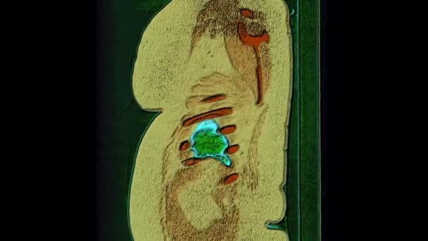 IRM couleur des poumons et des bronches, diagnostic des maladies respiratoires 