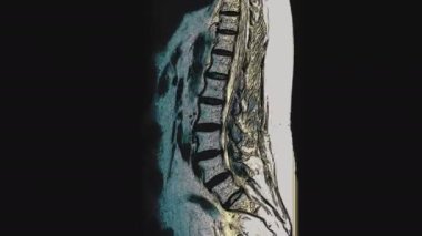 Kadın pelvis organlarının, karın boşluğunun, bağırsak yolunun ve mesanenin çok renkli MR 'ı.