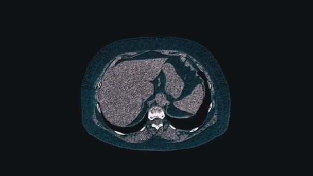 Objętościowy kolor MRI jamy brzusznej, przewodu pokarmowego, pęcherza moczowego — Wideo stockowe