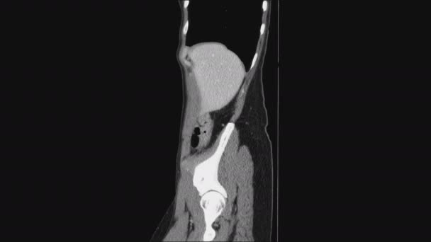 メスの骨盤器官、腹腔、消化管、膀胱のMRI — ストック動画