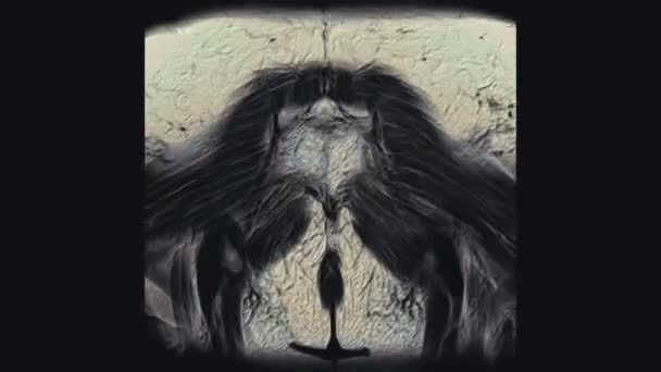 Wielobarwne MRI żeńskich narządów miednicy, jamy brzusznej, przewodu pokarmowego i pęcherza moczowego — Wideo stockowe