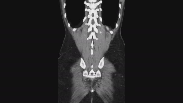 MRI van de vrouwelijke bekkenorganen, buikholte, maagdarmkanaal en blaas — Stockvideo