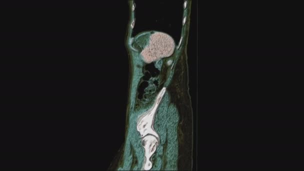 RM multicolorida a granel dos órgãos pélvicos femininos, cavidade abdominal, trato gastrointestinal e bexiga — Vídeo de Stock