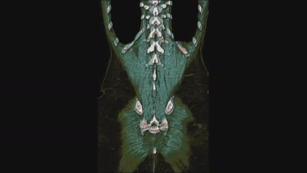 Bulk multicolored MRI of the female pelvic organs, abdominal cavity, gastrointestinal tract and bladder — Stock Video