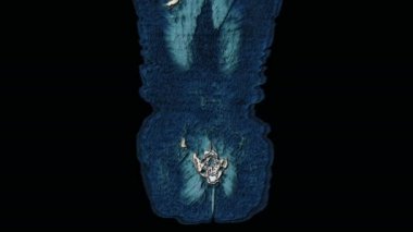 Karın boşluğunun, gastrointestinal bölgenin, mesanenin çok renkli MR 'ı.