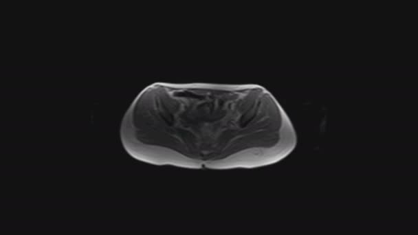 メスの骨盤器官、腹腔、消化管、膀胱のMRI — ストック動画