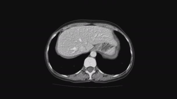 여성의 골반 기관, 복강, 위장, 방광에 대한 휘발성 MRI — 비디오