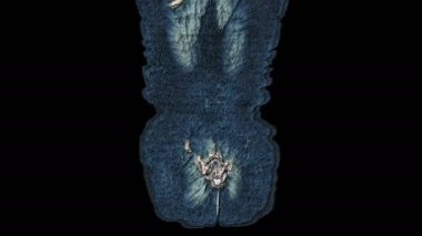 Karın boşluğunun, gastrointestinal bölgenin, mesanenin çok renkli MR 'ı.