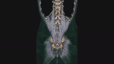 Kadın pelvis organlarının, karın boşluğunun, bağırsak yolunun ve mesanenin çok renkli MR 'ı.