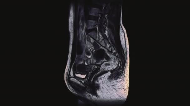 Έντονος χρωματικός MRI γυναικείων πυελικών οργάνων, κοιλιακής κοιλότητας, γαστρεντερικού σωλήνα και ουροδόχου κύστης — Αρχείο Βίντεο