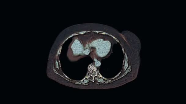 Bulk veelkleurige MRI van de buikholte, maag-darmkanaal, blaas — Stockvideo