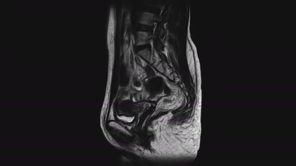 Voluminous MRI of the female pelvic organs, abdominal cavity, gastrointestinal tract and bladder — Stock Footage Voluminous MRI of the female pelvic organs, abdominal cavity, gastrointestinal tract and bladder Royalty Free Stock Footage