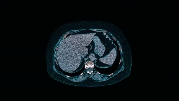 Resonancia magnética multicolor a granel de la cavidad abdominal, tracto gastrointestinal, vejiga — Vídeos de Stock