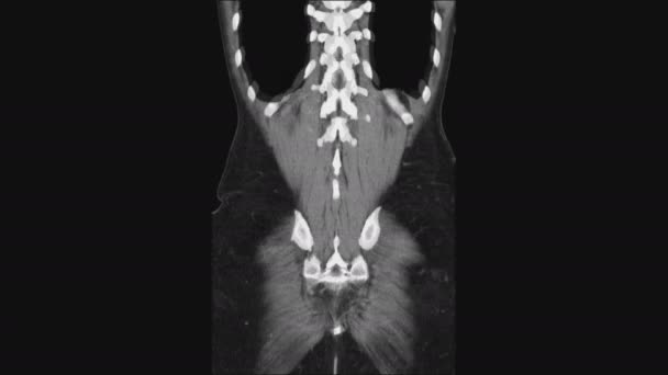 MRI ženských pánevních orgánů, břišní dutiny, gastrointestinálního traktu a močového měchýře — Stock video