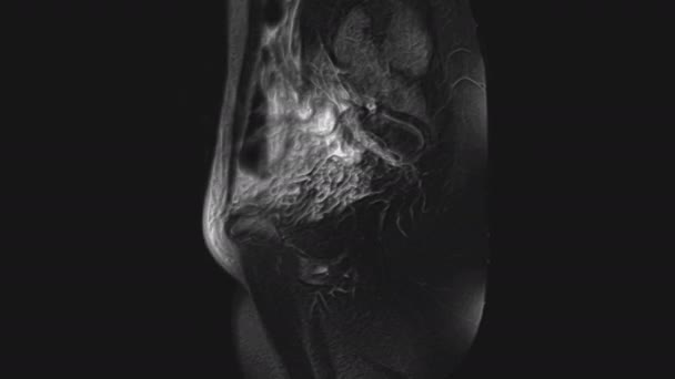 Об'ємна МРТ органів малого тазу, черевної порожнини, шлунково-кишкового тракту та сечового міхура — стокове відео