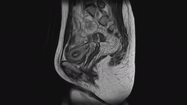 Объем МРТ женских тазовых органов, брюшной полости, желудочно-кишечного тракта и мочевого пузыря — стоковое видео