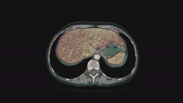 RM multicolorida a granel dos órgãos pélvicos femininos, cavidade abdominal, trato gastrointestinal e bexiga — Vídeo de Stock