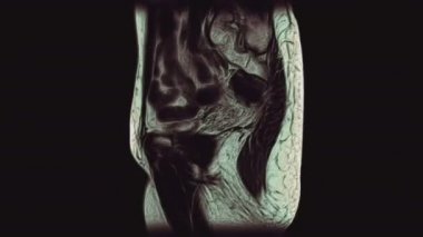 Kadın pelvis organlarının, karın boşluğunun, bağırsak yolunun ve mesanenin çok renkli MR 'ı.