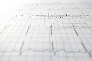 Kalp testi EKG levha baskı