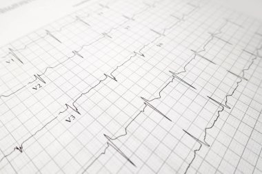 EKG kalp Beat test yakın çekim