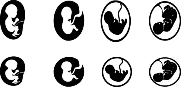 Illustration Vectorielle Foetus Isolée Sur Fond — Image vectorielle