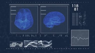 Yüksek teknolojili bir ekranın 4k 'lık videosu bir beyni 3 boyutlu olarak gösterir.