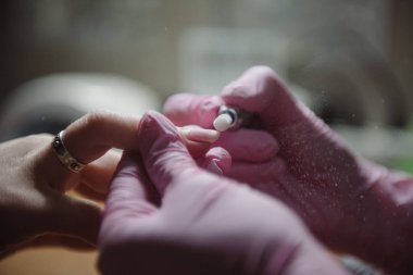 Manikürcü donanım manikür yakın çekim yapar. Hırdavat manikür yardımı ile çivi tedavisi