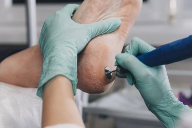 Güzellik salonunda profesyonel pedikür yaptıran genç bir kadın. Güzellik salonunda ayak pedikürü ameliyatı..