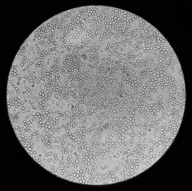 microscopic view of the fungi candida albicans clipart