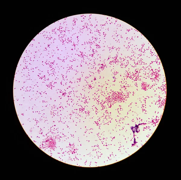 Vista microscopica della gonorrea (Neisseria gonorrhoeae ) — Foto Stock