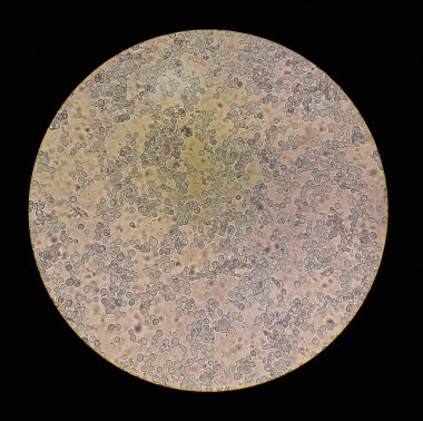 mikroskobik mantarlar candida albicans görünümünü
