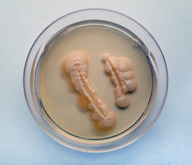 candida albicans grown on a nutrient environment in a Petri dish clipart