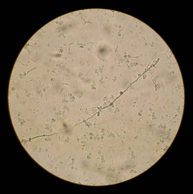 mikroskobik mantarlar candida albicans yerli hazırlık görünümünü