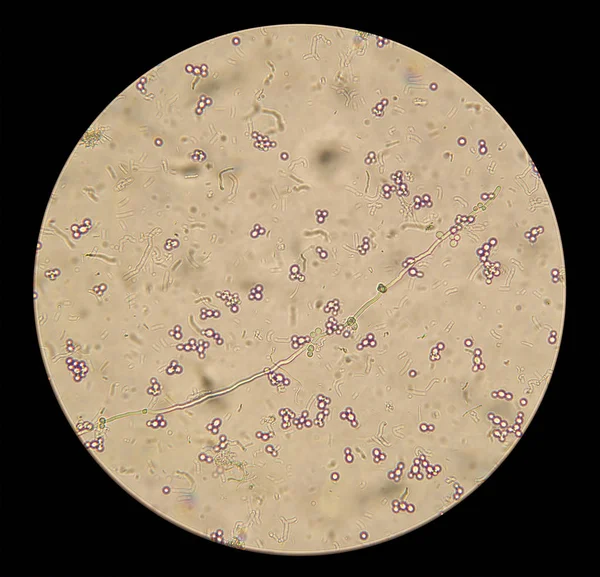 Visão microscópica dos fungos candida albicans na preparação nativa — Fotografia de Stock