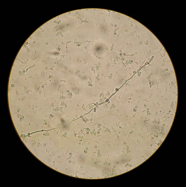 Vue microscopique des champignons candida albicans dans la préparation native — Photo