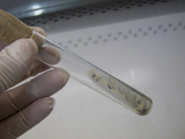 Tüp sitokrom oksidaz pozitif tepki sonra bel soğukluğu (Neisseria gonorrhoeae) Yetişkin kolonileri