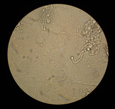 Yerel hazırlık mantar Aspergillus mikroskobik görünümü